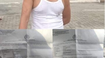 Keadilan Tertunda, Pelaku Penganiayaan Bebas Melenggang. Korban Dianiaya Dihina Dan Di Lecehkan
