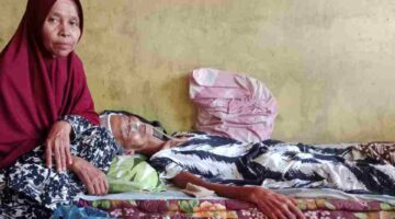 Mengindap Tumor Otak Stadium 4 Salbiah Butuh Uluran Tangan Dermawan